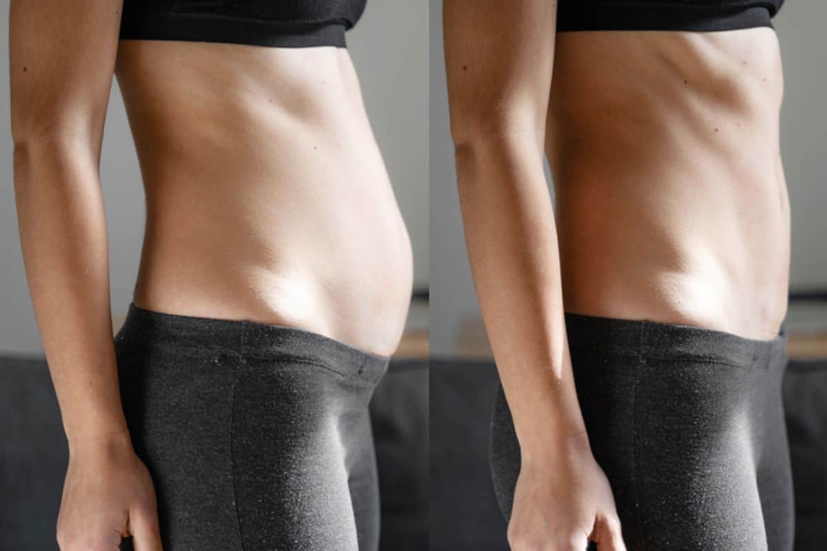 Post-Pregnancy: What Happens to Your Abdominal Muscles After Birth Elstree