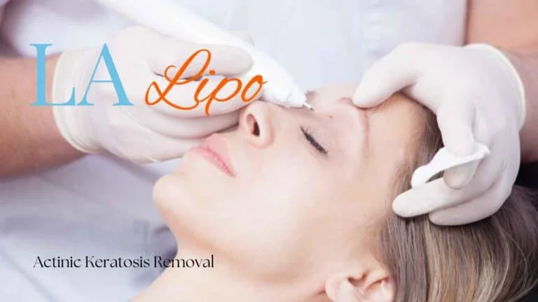 Woman receiving Actinic Keratosis Removal Treatment Elstree