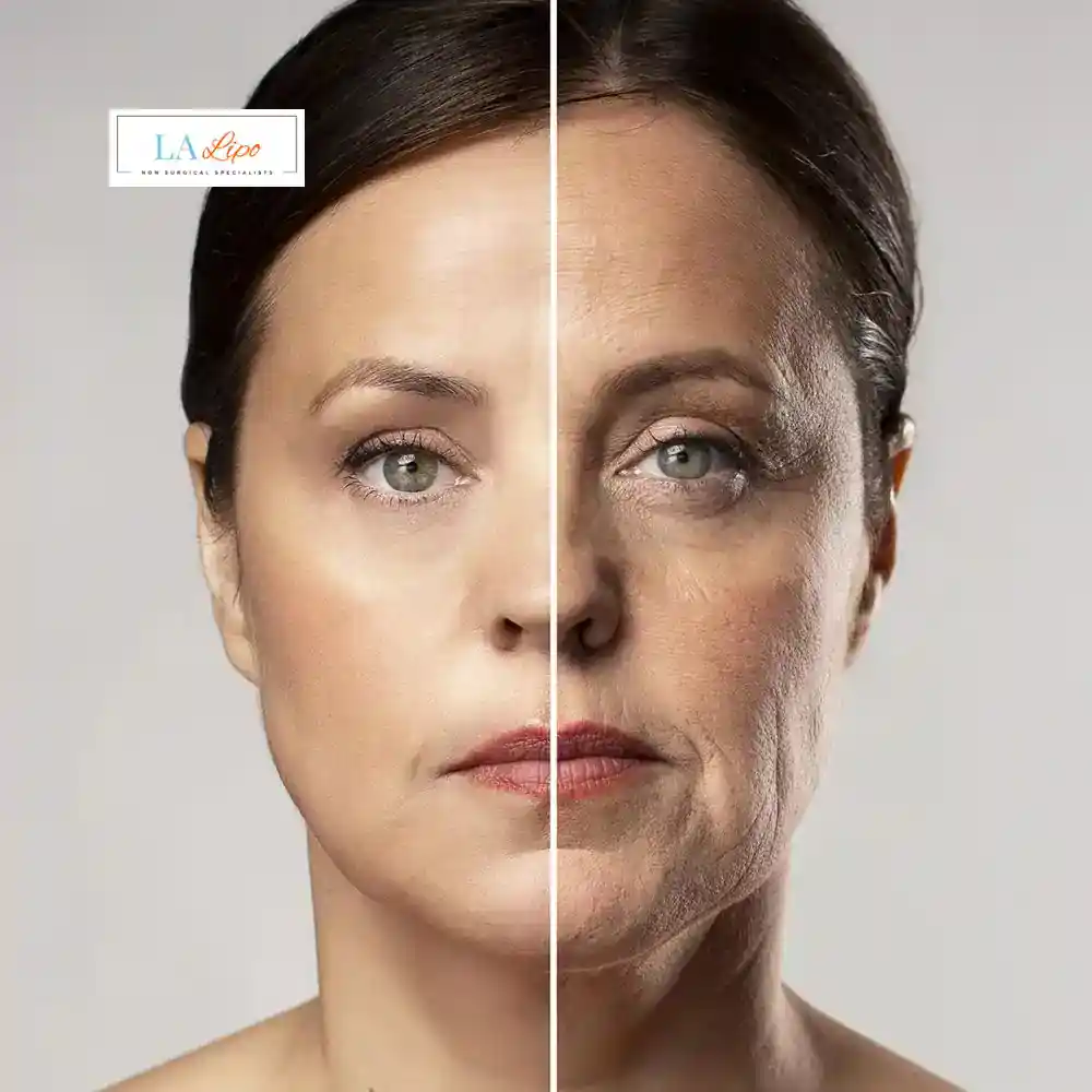 How Can You Tell If Non-Surgical Skin Tightening Is Right for You Elstree?