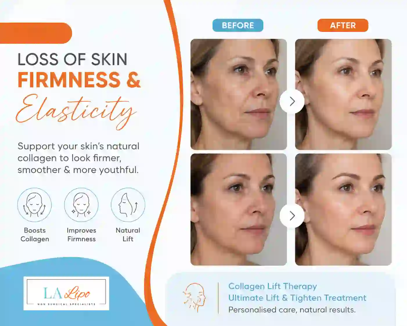 Sign #7: Loss of Skin Firmness and Elasticity Elstree